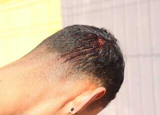 Jovem &eacute; agredido com coronhada em assalto e tem celular e bicicleta levados