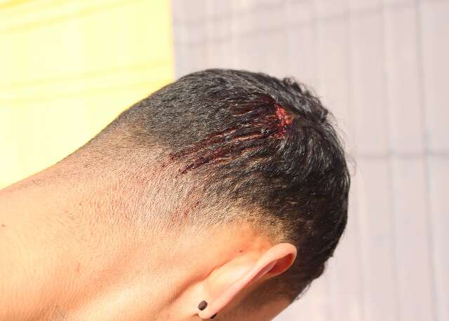 Jovem &eacute; agredido com coronhada em assalto e tem celular e bicicleta levados
