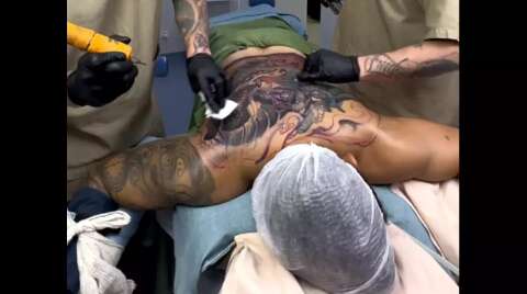 Conselho pro&iacute;be o uso de anestesia geral e seda&ccedil;&atilde;o para realiza&ccedil;&atilde;o de tatuagens