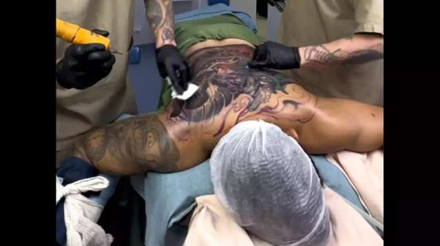 Conselho pro&iacute;be o uso de anestesia geral e seda&ccedil;&atilde;o para realiza&ccedil;&atilde;o de tatuagens