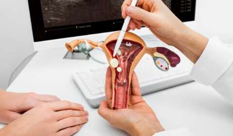 Jovem consegue na Justi&ccedil;a direito &agrave; cirurgia para tratar miomas uterinos