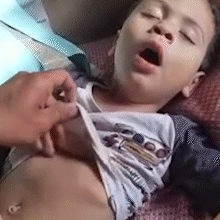 Aos 2 anos, Pietro enfrenta diagn&oacute;stico triplo e m&atilde;e pede ajuda para cirurgia