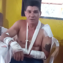 Jaguatirica morre atropelada por motocicleta e homem diz ter sido atacado