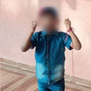 Menino de 8 anos respira por aparelhos ap&oacute;s ser picado por escorpi&atilde;o