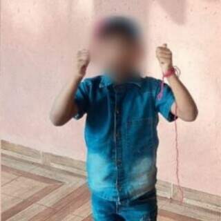 Menino de 8 anos respira por aparelhos ap&oacute;s ser picado por escorpi&atilde;o