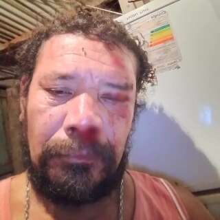 &quot;N&atilde;o desejo o que passei para ningu&eacute;m&quot;, conta sobrevivente de ataque de on&ccedil;a