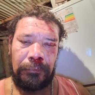 &quot;N&atilde;o desejo o que passei pra ningu&eacute;m&quot;, conta sobrevivente de ataque de on&ccedil;a