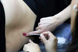 Curso forma m&eacute;dicos para oferecer acupuntura em unidades de sa&uacute;de de MS