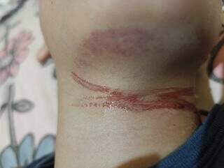 Fio solto fere pesco&ccedil;o de crian&ccedil;a em Rio Brilhante