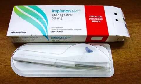 Implante contraceptivo deve ser ofertado por planos a partir de hoje