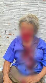 &ldquo;Irreconhec&iacute;vel e em choque&rdquo;, diz fam&iacute;lia de idoso desfigurado por pitbull