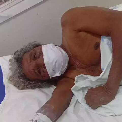 &ldquo;Irreconhec&iacute;vel e em choque&rdquo;, diz fam&iacute;lia de idoso desfigurado por pitbull