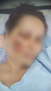 &ldquo;Vi o clar&atilde;o e apaguei, mas sabia que era ele&rdquo;, diz mulher atropelada pelo ex