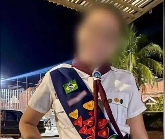 Menina de 10 anos sofre queimaduras com chapa e fica em estado grave