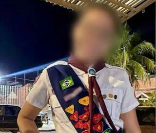 Menina de 10 anos sofre queimaduras com chapa e fica em estado grave