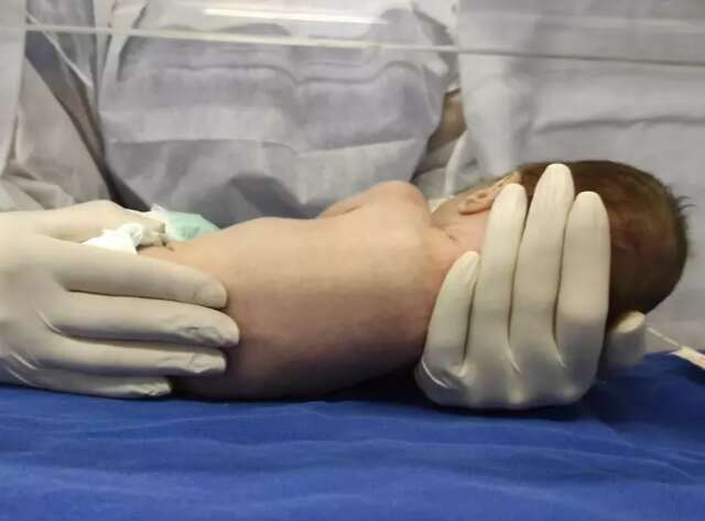 Estudo no HU refor&ccedil;a benef&iacute;cios de fisioterapia e canguru em beb&ecirc;s prematuros