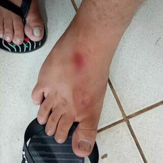 Adolescente de 14 anos &eacute; atacado por pitbull solto no Jardim Jacy