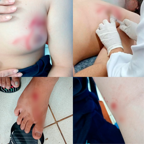 Adolescente de 14 anos &eacute; atacado por pitbull solto no Jardim Jacy