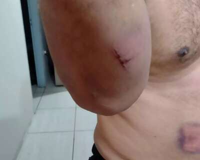 Porteiro apanha de cassetete ao tentar pedir socorro por furto de celular