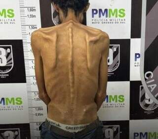 Com uma vida de crime e drogas, homem de 32 anos choca por apar&ecirc;ncia raqu&iacute;tica 