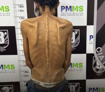Com uma vida de crime e drogas, homem de 32 anos choca por apar&ecirc;ncia raqu&iacute;tica 