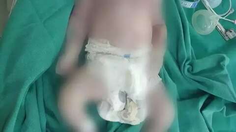 Hospitais em MS v&atilde;o adotar &quot;check-list&quot; para evitar mortes durante partos 