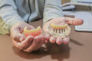 Mega Plantão da Redeorto CG oferece desconto de até 20% em implantes dentários Mega Plantão da Redeorto CG oferece desconto de até 20% em implantes dentários