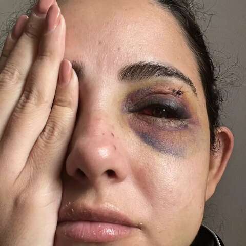 &ldquo;Quis acabar comigo&rdquo;: mulher denuncia ex por espancamento, estupro e c&aacute;rcere
