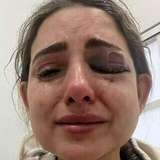 “Quis acabar comigo”: mulher denuncia ex por espancamento, estupro e cárcere “Quis acabar comigo”: mulher denuncia ex por espancamento, estupro e cárcere