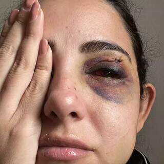 Estudante de Medicina que espancou a ex foi condenado por tentar matar policial Estudante de Medicina que espancou a ex foi condenado por tentar matar policial