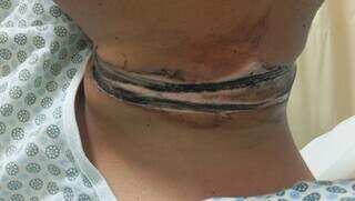 Jovem quase morre degolado com fia&ccedil;&atilde;o solta no meio da rua