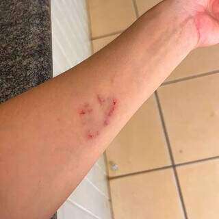 Dois ataques de pitbulls em sequência expõem risco nas ruas de Campo Grande Dois ataques de pitbulls em sequência expõem risco nas ruas de Campo Grande