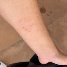 Dois ataques de pitbulls em sequ&ecirc;ncia exp&otilde;em risco nas ruas de Campo Grande