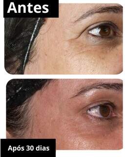 Na Cl&iacute;nica Corpo &amp; Pele, tirzepatida garante perda de peso saud&aacute;vel