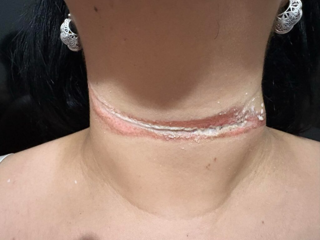 Professora quase &eacute; enforcada em 3&ordm; caso de fios soltos no m&ecirc;s