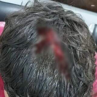 Ataque a tiros em pra&ccedil;a movimentada fere dois jovens em guerra de fac&ccedil;&otilde;es