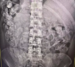 &ldquo;Corpo virou transporte barato e cruel&quot;, diz m&eacute;dico que salva mulas do tr&aacute;fico