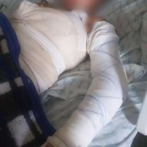 Homem &eacute; preso suspeito de queimar adolescente de 17 anos em fazenda 