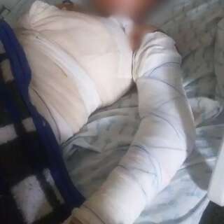 Homem &eacute; preso suspeito de queimar companheira de 17 anos em fazenda de MS