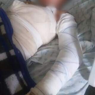 Homem é preso suspeito de queimar adolescente de 17 anos em fazenda Homem é preso suspeito de queimar adolescente de 17 anos em fazenda