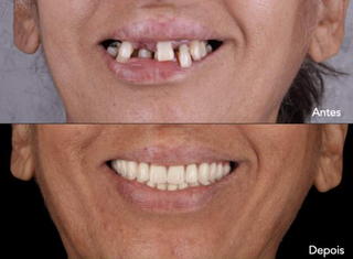 Seda&ccedil;&atilde;o consciente: conforto e seguran&ccedil;a para quem teme a cadeira do dentista