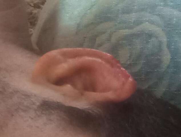 Homem morde e arranca orelha de vizinho em briga por som alto 