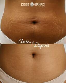 Deise Girardi leva est&eacute;tica avan&ccedil;ada ao interior e lota agenda no ver&atilde;o