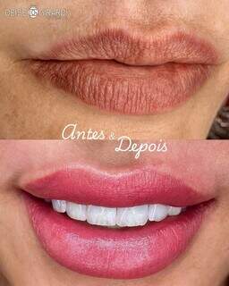 Deise Girardi leva est&eacute;tica avan&ccedil;ada ao interior e lota agenda no ver&atilde;o