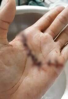 “Me sinto passarinho com a asa quebrada”, diz artista ferido em assalto “Me sinto passarinho com a asa quebrada”, diz artista ferido em assalto