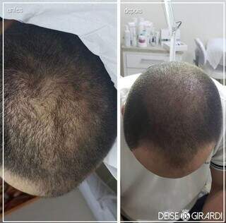 Deise Girardi leva est&eacute;tica avan&ccedil;ada ao interior e lota agenda no ver&atilde;o