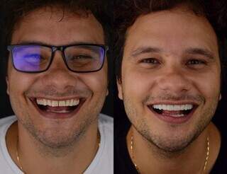 Procura por lentes em resina cresce em Campo Grande no fim do ano