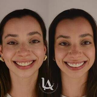 Procura por lentes em resina cresce em Campo Grande no fim do ano