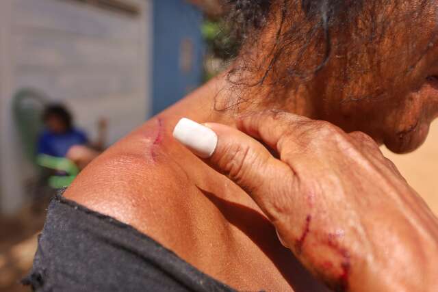 Mulher é esfaqueada ao impedir que inquilina fosse morta pelo companheiro