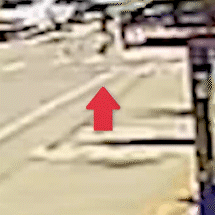 Idoso atropelado ao tentar atravessar rua tem perna amputada